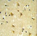 MPV17 Antibody - Formalin-fixed and paraffin-embedded human brain tissue reacted with MPV17 Antibody , which was peroxidase-conjugated to the secondary antibody, followed by DAB staining. This data demonstrates the use of this antibody for immunohistochemistry; clinical relevance has not been evaluated.