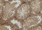 MPZ / P0 Antibody - 1:100 staining mouse testis tissue by IHC-P. The sample was formaldehyde fixed and a heat mediated antigen retrieval step in citrate buffer was performed. The sample was then blocked and incubated with the antibody for 1.5 hours at 22°C. An HRP conjugated goat anti-rabbit antibody was used as the secondary.