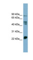 MPZL1 Antibody - MPZL1 antibody Western blot of PANC1 cell lysate. This image was taken for the unconjugated form of this product. Other forms have not been tested.