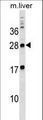 MPZL3 Antibody - MPZL3 Antibody western blot of mouse liver tissue lysates (35 ug/lane). The MPZL3 antibody detected the MPZL3 protein (arrow).