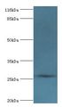 MRDS1 / OFCC1 Antibody - Western blot. All lanes: Orofacial cleft 1 candidate gene 1 antibody at 2 ug/ml+mouse gonad tissue. Secondary antibody: Goat polyclonal to rabbit at 1:10000 dilution. Predicted band size: 27 kDa. Observed band size: 27 kDa.  This image was taken for the unconjugated form of this product. Other forms have not been tested.