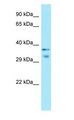 MRGX1 / MRGPRX1 Antibody - MRGX1 / MRGPRX1 antibody Western Blot of Fetal Small Intestine.  This image was taken for the unconjugated form of this product. Other forms have not been tested.