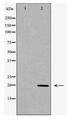 MRLC2 / MYL12B Antibody - Western blot of MRLC2 expression in K562 cell extract