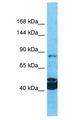 MROH1 / HEATR7A Antibody - MROH1 / HEATR7A antibody Western Blot of OVCAR-3. Antibody dilution: 1 ug/ml.  This image was taken for the unconjugated form of this product. Other forms have not been tested.