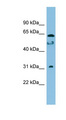 MROH8 Antibody - C20orf132 antibody Western blot of Jurkat lysate. This image was taken for the unconjugated form of this product. Other forms have not been tested.