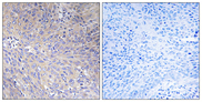 MRPL11 Antibody - Immunohistochemistry analysis of paraffin-embedded human cervix carcinoma tissue, using MRPL11 Antibody. The picture on the right is blocked with the synthesized peptide.