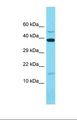 MRPL14 Antibody - Western blot of Human 721_B. MRPL14 antibody dilution 1.0 ug/ml.  This image was taken for the unconjugated form of this product. Other forms have not been tested.
