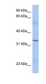 MRPL15 Antibody - MRPL15 antibody Western blot of PANC1 cell lysate. This image was taken for the unconjugated form of this product. Other forms have not been tested.