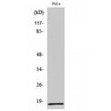 MRPL20 Antibody - Western blot of MRP-L20 antibody