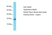 MRPL22 Antibody -  This image was taken for the unconjugated form of this product. Other forms have not been tested.