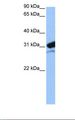 MRPL24 Antibody - 721_B cell lysate. Antibody concentration: 0.5 ug/ml. Gel concentration: 12%.  This image was taken for the unconjugated form of this product. Other forms have not been tested.