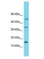 MRPL30 Antibody - MRPL30 antibody Western Blot of HeLa. Antibody dilution: 1 ug/ml.  This image was taken for the unconjugated form of this product. Other forms have not been tested.