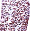 MRPL33 Antibody - RM33 Antibody immunohistochemistry of formalin-fixed and paraffin-embedded human heart tissue followed by peroxidase-conjugated secondary antibody and DAB staining.