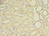 MRPL33 Antibody - Immunohistochemistry of paraffin-embedded human kidney tissue using antibody at dilution of 1:100.