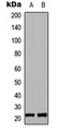 MRPL35 Antibody - Western blot analysis of MRPL35 expression in COLO205 (A); HEK293T (B) whole cell lysates.