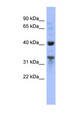 MRPL37 Antibody - MRPL37 antibody Western blot of 293T cell lysate. This image was taken for the unconjugated form of this product. Other forms have not been tested.