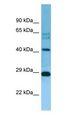 MRPL38 Antibody - MRPL38 antibody Western Blot of Jurkat.  This image was taken for the unconjugated form of this product. Other forms have not been tested.