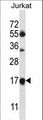 MRPL41 / PIG3 / BMRP Antibody - MRPL41 Antibody western blot of Jurkat cell line lysates (35 ug/lane). The MRPL41 antibody detected the MRPL41 protein (arrow).