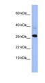 MRPL47 Antibody - MRPL47 antibody Western blot of HepG2 cell lysate. This image was taken for the unconjugated form of this product. Other forms have not been tested.