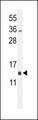 MRPL51 Antibody - RM51 Antibody western blot of mouse bladder tissue lysates (35 ug/lane). The RM51 antibody detected the RM51 protein (arrow).