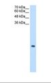 MRPS12 / RPSM12 Antibody - Jurkat cell lysate. Antibody concentration: 0.5 ug/ml. Gel concentration: 15%.  This image was taken for the unconjugated form of this product. Other forms have not been tested.