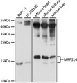 MRPS14 Antibody - Western blot analysis of extracts of various cell lines, using MRPS14 antibody at 1:1000 dilution. The secondary antibody used was an HRP Goat Anti-Rabbit IgG (H+L) at 1:10000 dilution. Lysates were loaded 25ug per lane and 3% nonfat dry milk in TBST was used for blocking. An ECL Kit was used for detection and the exposure time was 10s.