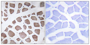 MRPS18C Antibody - Immunohistochemistry analysis of paraffin-embedded human skeletal muscle tissue, using MRPS18C Antibody. The picture on the right is blocked with the synthesized peptide.