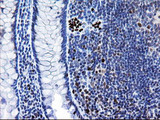 MRPS27 Antibody - IHC of paraffin-embedded Human colon tissue using anti-MRPS27 mouse monoclonal antibody.