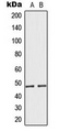 MRPS27 Antibody - Western blot analysis of MRPS27 expression in HeLa (A); A549 (B) whole cell lysates.
