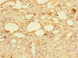 MRPS28 Antibody - Immunohistochemistry of paraffin-embedded human adrenal gland tissue using MRPS28 Antibody at dilution of 1:100