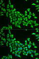 MRPS30 Antibody - Immunofluorescence analysis of HeLa cells.