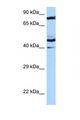 MRPS31 Antibody - MRPS31 antibody Western blot of HT1080 Cell lysate. Antibody concentration 1 ug/ml.  This image was taken for the unconjugated form of this product. Other forms have not been tested.