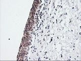 MRPS34 Antibody - IHC of paraffin-embedded Human bladder tissue using anti-MRPS34 mouse monoclonal antibody.
