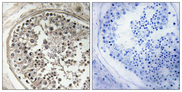 MRPS5 Antibody - Immunohistochemistry analysis of paraffin-embedded human testis, using MRPS5 Antibody. The picture on the right is blocked with the synthesized peptide.