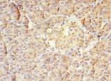 MS / MTR Antibody - Immunohistochemistry of paraffin-embedded Human pancreatic tissue using antibody at 1:100 dilution.