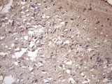 MS4A12 Antibody - Immunohistochemical staining of paraffin-embedded Human adult brain tissue using anti-MS4A12 mouse monoclonal antibody. (Heat-induced epitope retrieval by 1mM EDTA in 10mM Tris buffer. (pH8.5) at 120 oC for 3 min. (1:150)