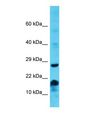 MS4A6E Antibody - Western blot of MS4A6E Antibody - middle region with human Jurkat cells lysate.  This image was taken for the unconjugated form of this product. Other forms have not been tested.