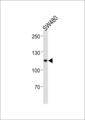 MSH2 Antibody - MSH2 Antibody western blot of SW480,U251 cell line lysates (35 ug/lane). The MSH2 antibody detected the MSH2 protein (arrow).