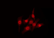 MSH3 Antibody - Staining HuvEc cells by IF/ICC. The samples were fixed with PFA and permeabilized in 0.1% Triton X-100, then blocked in 10% serum for 45 min at 25°C. The primary antibody was diluted at 1:200 and incubated with the sample for 1 hour at 37°C. An Alexa Fluor 594 conjugated goat anti-rabbit IgG (H+L) Ab, diluted at 1/600, was used as the secondary antibody.