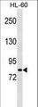 MSH5 Antibody - MSH5 Antibody western blot of HL-60 cell line lysates (35 ug/lane). The MSH5 antibody detected the MSH5 protein (arrow).