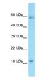 MSMB / MSP Antibody - MSMB / MSP antibody Western Blot of MCF7 cell lysate. MSMB is strongly supported by BioGPS gene expression data to be expressed in Human MCF7 cells.  This image was taken for the unconjugated form of this product. Other forms have not been tested.
