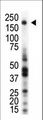 MST1R / RON Antibody - Western blot of anti-RON antibody in THP1 cell lysate. RON (arrow) was detected using purified antibody. Secondary HRP-anti-rabbit was used for signal visualization with chemiluminescence.