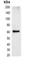 mStrawberry Tag Antibody - Western blot analysis of over-expressed mStrawberry-tagged protein in 293T cell lysate.