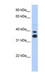 MSX2 / MSH Antibody - MSX2 antibody Western blot of Transfected 293T cell lysate. This image was taken for the unconjugated form of this product. Other forms have not been tested.
