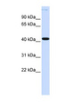 MSY2 / YBX2 Antibody - YBX2 antibody Western blot of Fetal Lung lysate. This image was taken for the unconjugated form of this product. Other forms have not been tested.