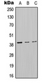 MT-ND2 Antibody - Western blot analysis of MT-ND2 expression in HepG2 (A); Raw264.7 (B); PC12 (C) whole cell lysates.