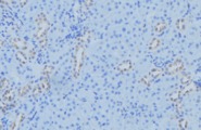 MT-ND2 Antibody - 1:100 staining mouse kidney tissue by IHC-P. The sample was formaldehyde fixed and a heat mediated antigen retrieval step in citrate buffer was performed. The sample was then blocked and incubated with the antibody for 1.5 hours at 22°C. An HRP conjugated goat anti-rabbit antibody was used as the secondary.
