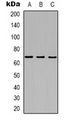 MT-ND5 Antibody - Western blot analysis of MT-ND5 expression in K562 (A); HeLa (B); mouse kidney (C) whole cell lysates.