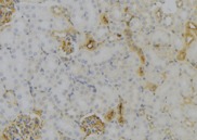 MT-ND6 Antibody - 1:100 staining mouse kidney tissue by IHC-P. The sample was formaldehyde fixed and a heat mediated antigen retrieval step in citrate buffer was performed. The sample was then blocked and incubated with the antibody for 1.5 hours at 22°C. An HRP conjugated goat anti-rabbit antibody was used as the secondary.