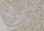 MT2A / Metallothionein 2A Antibody - 1:100 staining mouse heart tissue by IHC-P. The sample was formaldehyde fixed and a heat mediated antigen retrieval step in citrate buffer was performed. The sample was then blocked and incubated with the antibody for 1.5 hours at 22°C. An HRP conjugated goat anti-rabbit antibody was used as the secondary.